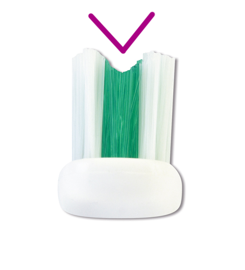 Carebrush-Ortho-Borsten-V
